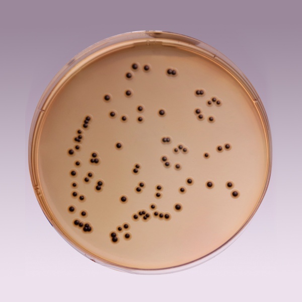 SS Agar, Granulated (Salmonella Shigella Agar, Granulated) 500G