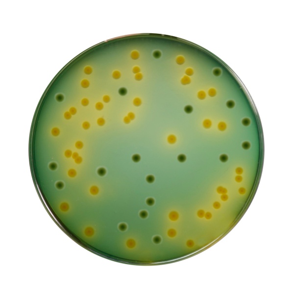 TCBS Agar 500G